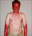 /album/galeria-de-fotos/sun-burn11-jpg/